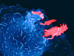 A macrophage engulfing Tuberculosis pathogen.