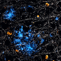 Nicht nur Nervenzellen bilden das Protein Beta-Amyloid (blau), das bei Alzheimer zu schädlichen Plaques verklumpt: Auch spezielle Gliazellen des Gehirns – die Oligodendrozyten (orange) – produzieren solche Ablagerungen. Weiß gefärbt das Myelin, das Nervenzellen isolierend umhüllt.